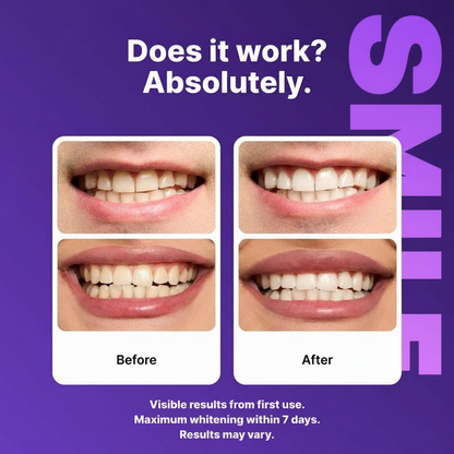 Purple Teeth Whitening Strip